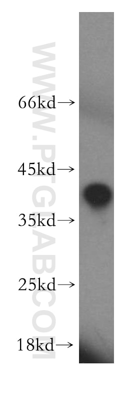 Western Blot (WB) analysis of mouse skin tissue using HAUS4 Polyclonal antibody (20104-1-AP)