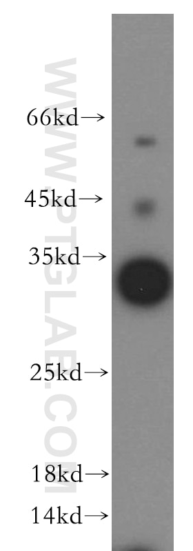 Western Blot (WB) analysis of human brain tissue using HAUS4 Polyclonal antibody (20104-1-AP)