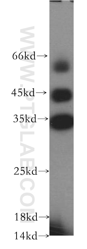 Western Blot (WB) analysis of mouse lung tissue using HAUS4 Polyclonal antibody (20104-1-AP)