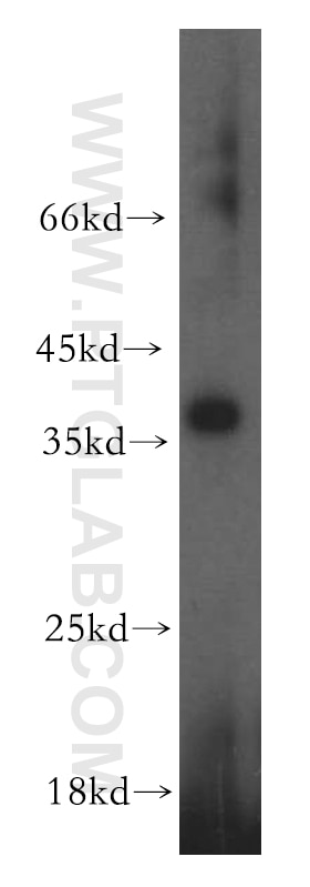 Western Blot (WB) analysis of human placenta tissue using HAUS4 Polyclonal antibody (20104-1-AP)