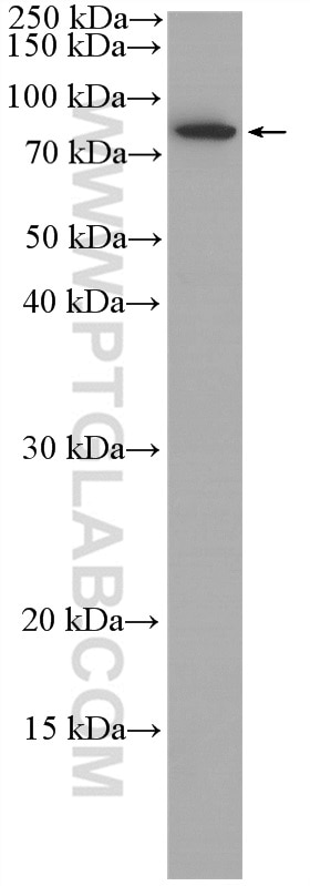 Western Blot (WB) analysis of A549 cells using HAVCR1 Polyclonal antibody (26420-1-AP)