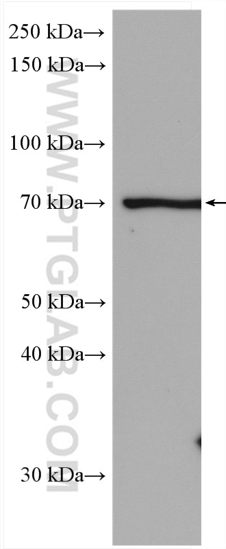 Western Blot (WB) analysis of Jurkat cells using HAVCR1 Polyclonal antibody (26420-1-AP)