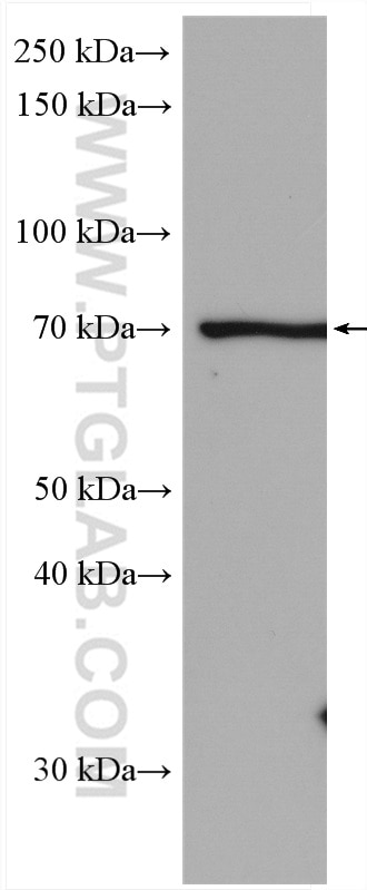 WB analysis of Jurkat using 26420-1-AP