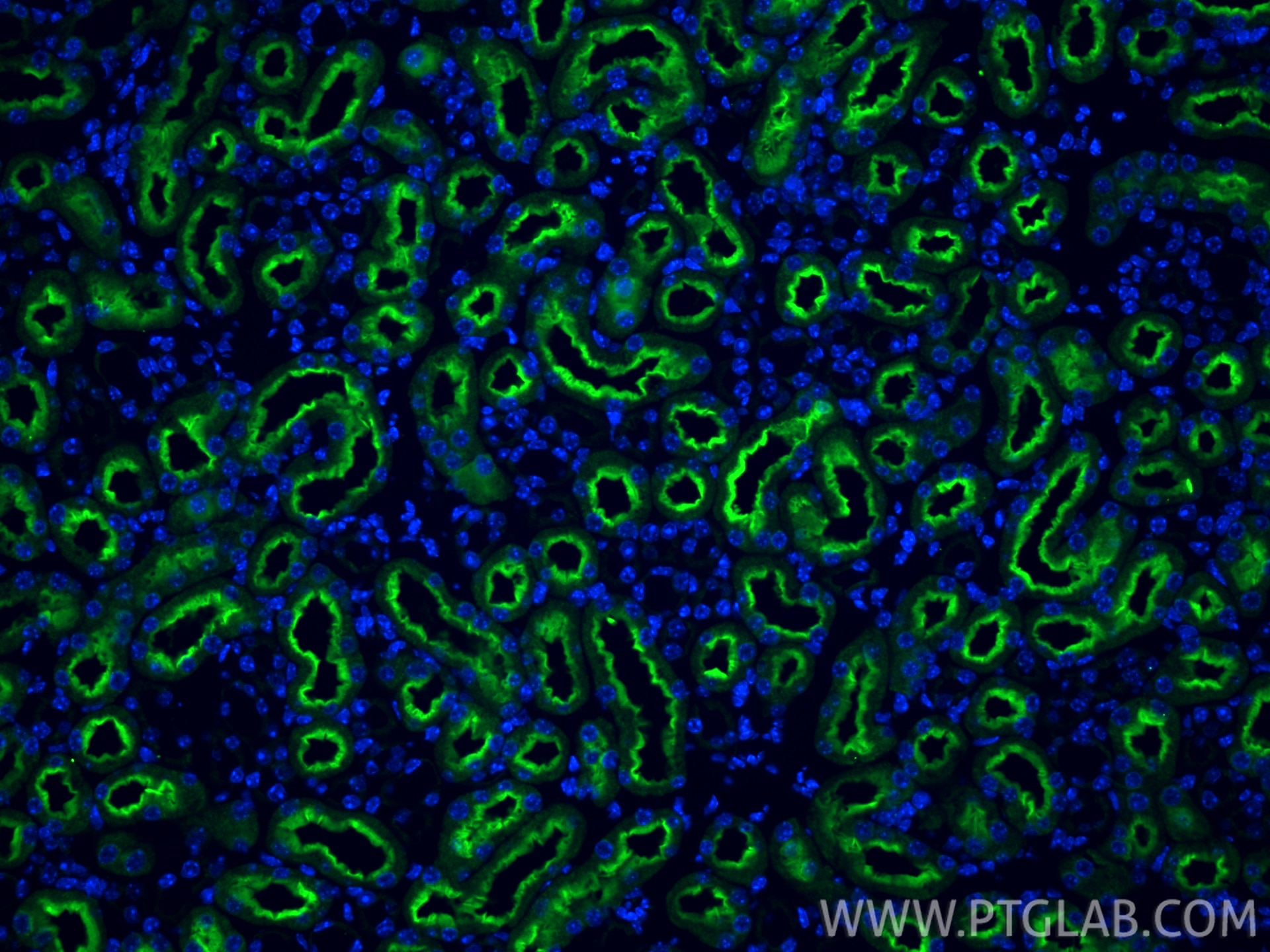 Immunofluorescent analysis of (4% PFA) fixed paraffin-embedded mouse kidney tissue using KIM-1/HAVCR1 antibody (30948-1-AP) at dilution of 1:400 and CoraLite®488-Conjugated Goat Anti-Rabbit IgG(H+L) (SA00013-2). Heat mediated antigen retrieval with Tris-EDTA buffer (pH 9.0). Immunofluorescence (IF) / fluorescent staining of mouse kidney tissue using KIM-1/HAVCR1 Polyclonal antibody (30948-1-AP)