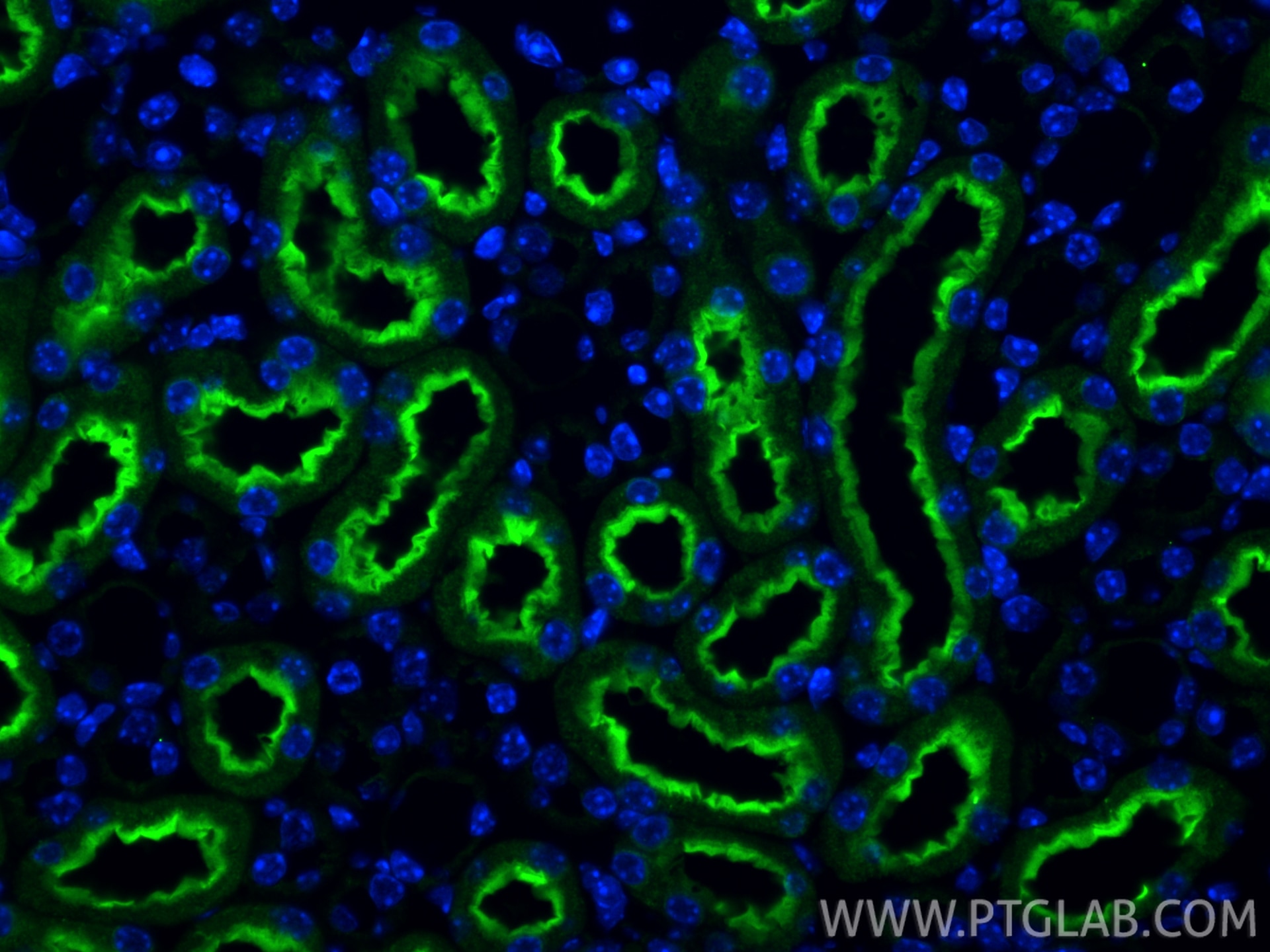 Immunofluorescent analysis of (4% PFA) fixed paraffin-embedded mouse kidney tissue using KIM-1/HAVCR1 antibody (30948-1-AP) at dilution of 1:400 and CoraLite®488-Conjugated Goat Anti-Rabbit IgG(H+L) (SA00013-2). Heat mediated antigen retrieval with Tris-EDTA buffer (pH 9.0). Immunofluorescence (IF) / fluorescent staining of mouse kidney tissue using KIM-1/HAVCR1 Polyclonal antibody (30948-1-AP)