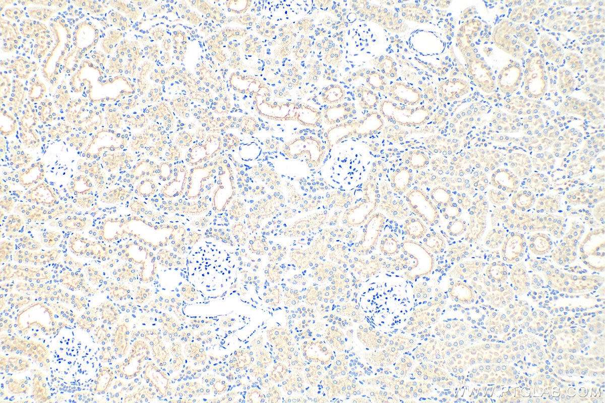 Immunohistochemistry (IHC) staining of rat kidney tissue using HAVCR1 Polyclonal antibody (30948-1-AP)