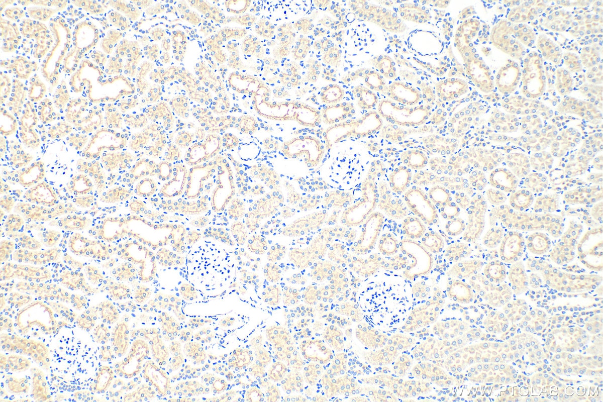 Immunohistochemistry (IHC) staining of rat kidney tissue using KIM-1/HAVCR1 Polyclonal antibody (30948-1-AP)