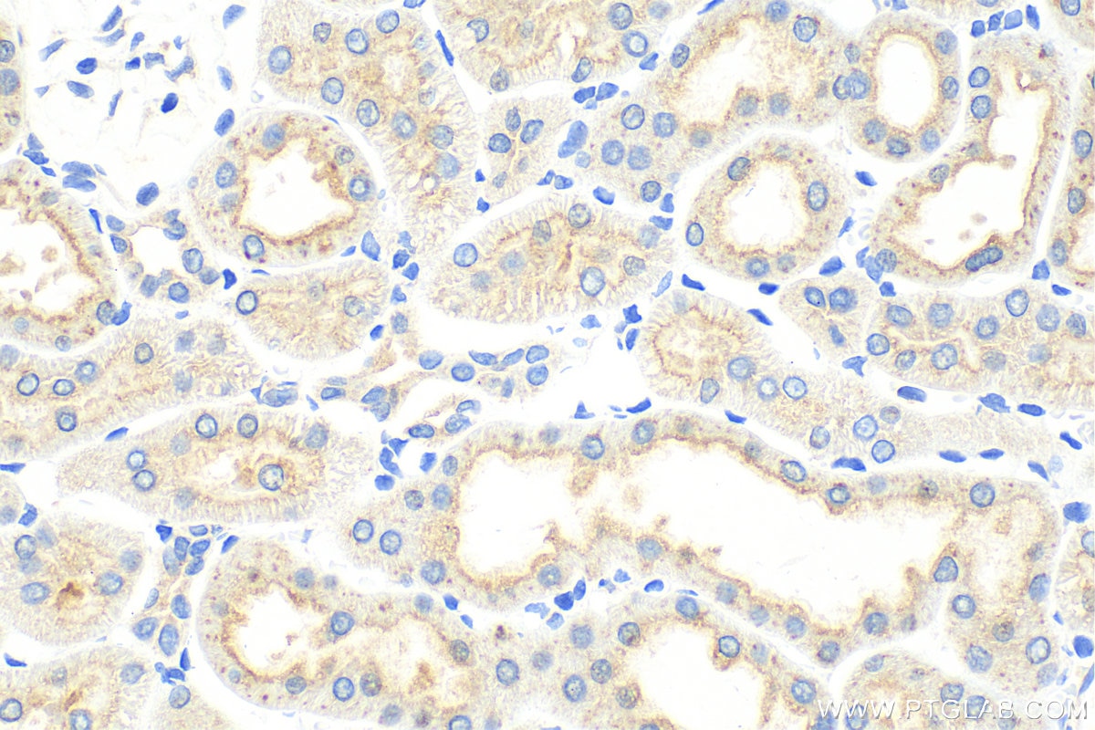 Immunohistochemistry (IHC) staining of rat kidney tissue using HAVCR1 Polyclonal antibody (30948-1-AP)