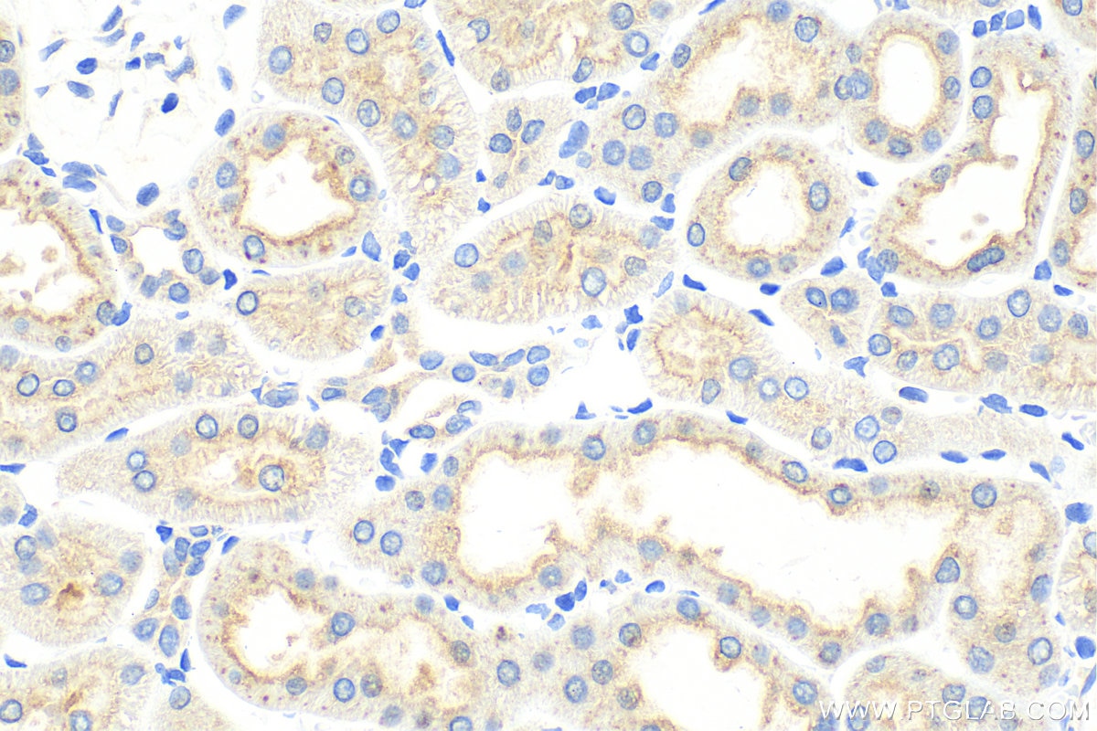 Immunohistochemistry (IHC) staining of rat kidney tissue using KIM-1/HAVCR1 Polyclonal antibody (30948-1-AP)