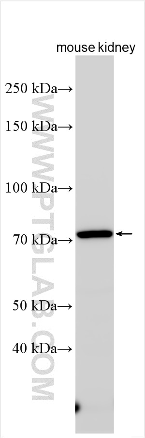 Western Blot (WB) analysis of various lysates using HAVCR1 Polyclonal antibody (30948-1-AP)