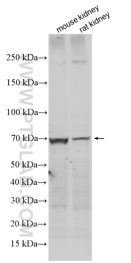 WB analysis using 30948-1-AP Western Blot (WB) analysis of various lysates using KIM-1/HAVCR1 Polyclonal antibody (30948-1-AP)