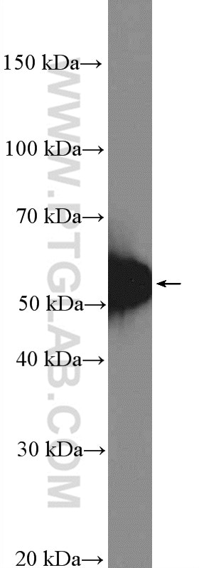 Western Blot (WB) analysis of Daudi  cells using TIM3 Polyclonal antibody (11872-1-AP)