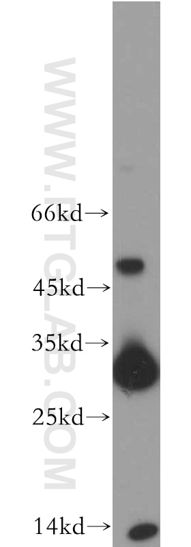 Western Blot (WB) analysis of Raji cells using TIM3 Polyclonal antibody (11872-1-AP)