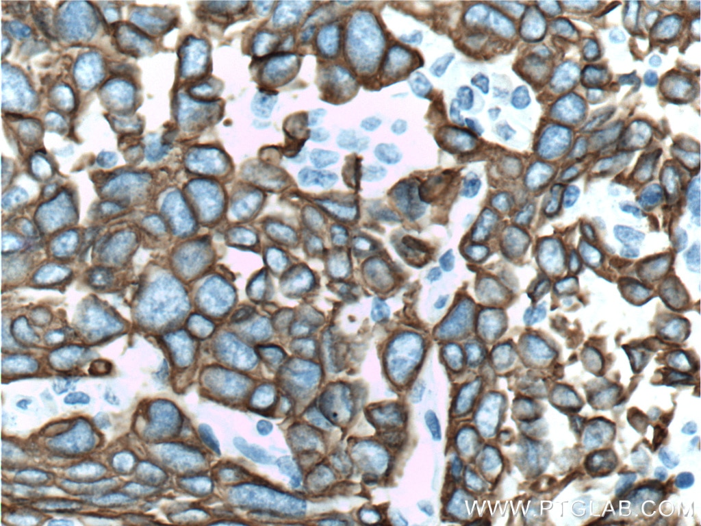 TIM3 Monoclonal antibody