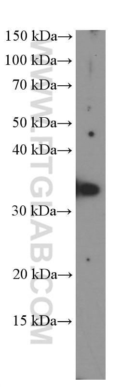 WB analysis of PC-3 using 60355-1-Ig