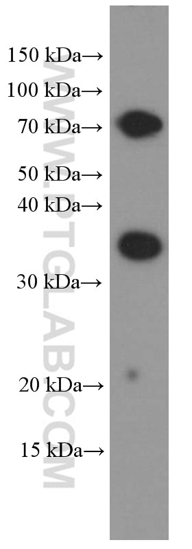 Western Blot (WB) analysis of Daudi cells using TIM3 Monoclonal antibody (60355-1-Ig)
