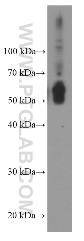 Western Blot (WB) analysis of ROS1728 cells using TIM3 Monoclonal antibody (60355-1-Ig)