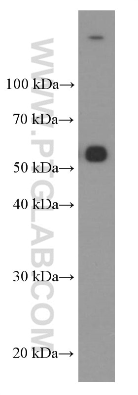 Western Blot (WB) analysis of human heart tissue using TIM3 Monoclonal antibody (60355-1-Ig)