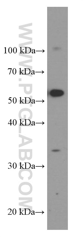 Western Blot (WB) analysis of RAW 264.7 cells using TIM3 Monoclonal antibody (60355-1-Ig)