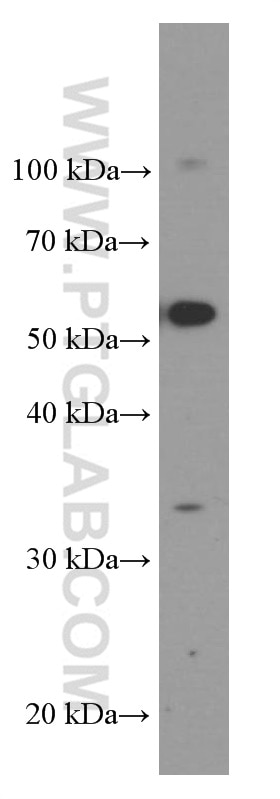 WB analysis of RAW 264.7 using 60355-1-Ig
