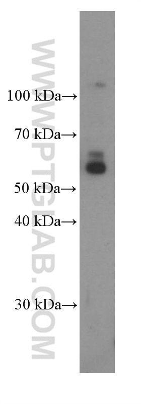 Western Blot (WB) analysis of rat heart tissue using TIM3 Monoclonal antibody (60355-1-Ig)