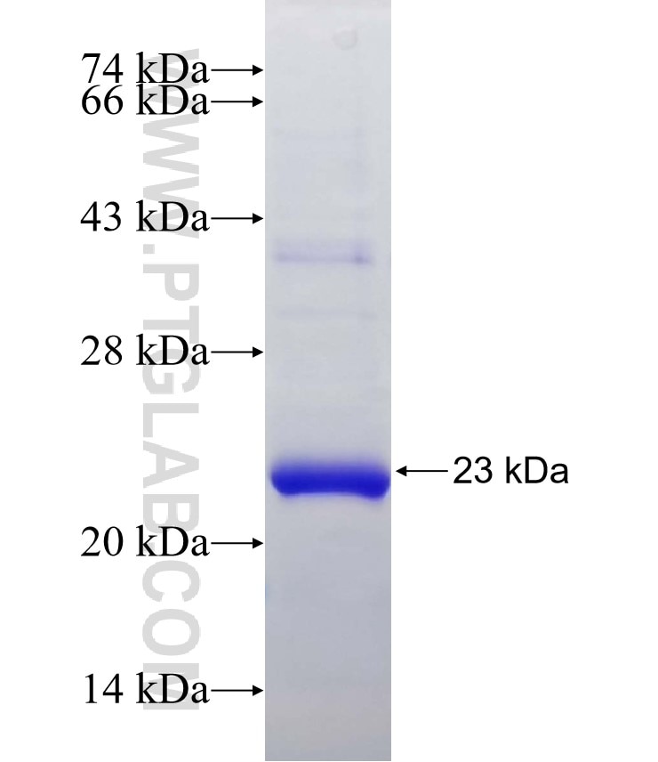 HAVCR2 fusion protein Ag27120 SDS-PAGE