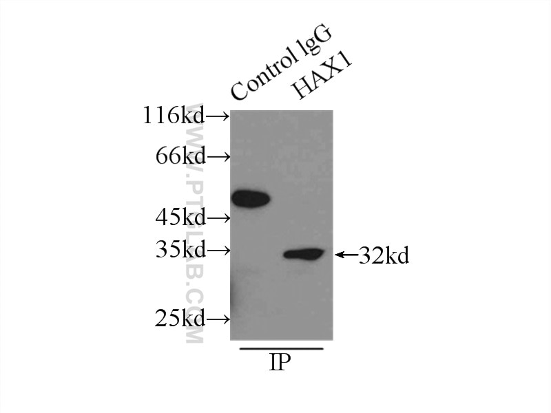 Immunoprecipitation (IP) experiment of mouse brain tissue using HAX1 Polyclonal antibody (11266-1-AP)