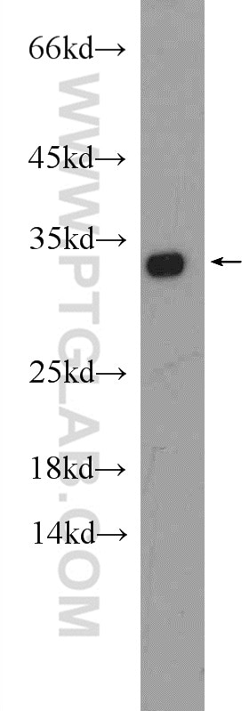 Western Blot (WB) analysis of HeLa cells using HAX1 Polyclonal antibody (11266-1-AP)