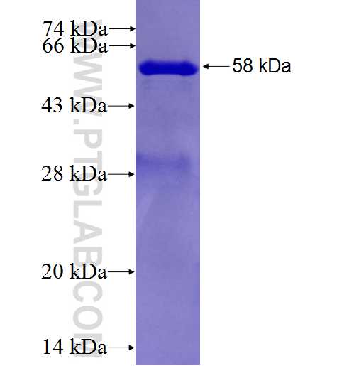 HAX1 fusion protein Ag1792 SDS-PAGE