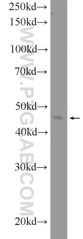 Western Blot (WB) analysis of mouse liver tissue using HB9 Polyclonal antibody (20975-1-AP)