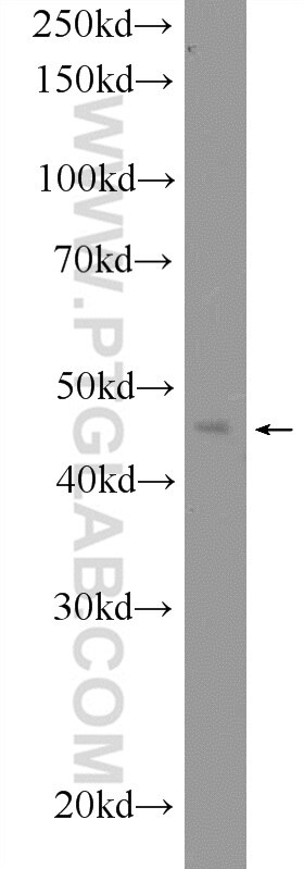 WB analysis of mouse liver using 20975-1-AP