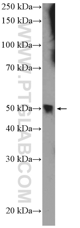 Western Blot (WB) analysis of mouse spleen tissue using HB9 Polyclonal antibody (20975-1-AP)