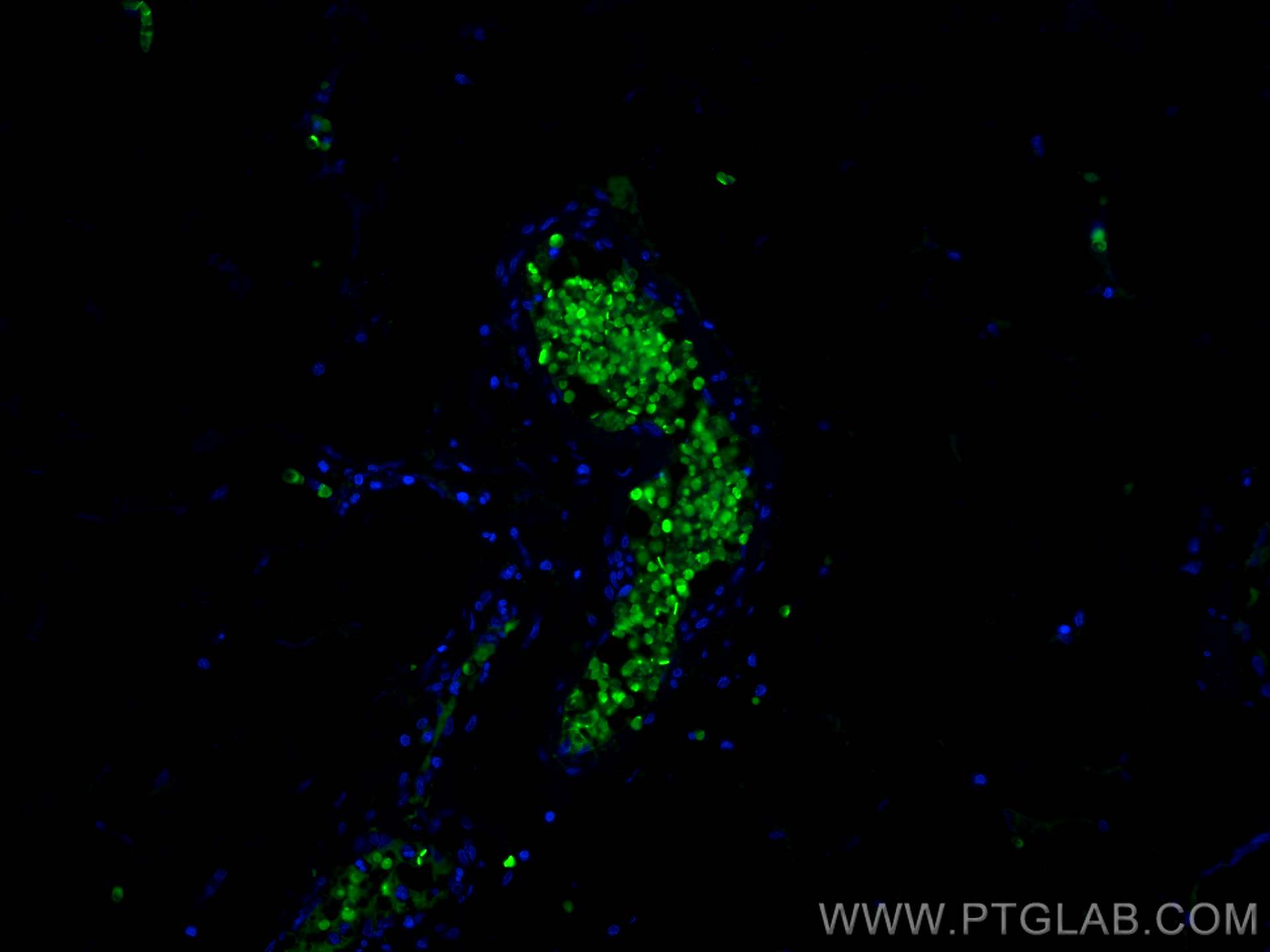 Immunofluorescence (IF) / fluorescent staining of human appendicitis tissue using Hemoglobin Alpha Polyclonal antibody (14537-1-AP)