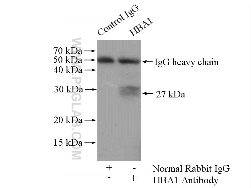 Immunoprecipitation (IP) experiment of mouse liver tissue using Hemoglobin Alpha Polyclonal antibody (14537-1-AP)