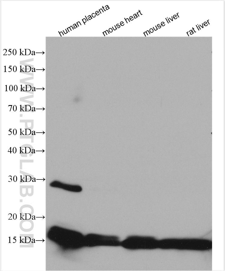 Western Blot (WB) analysis of various lysates using Hemoglobin Alpha Polyclonal antibody (14537-1-AP)