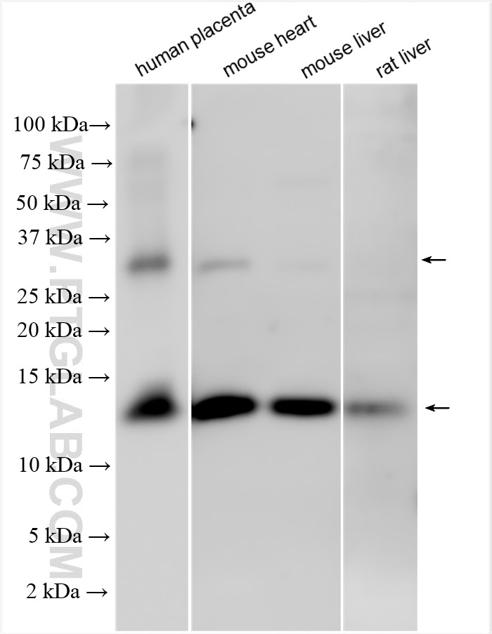 Western Blot (WB) analysis of various lysates using Hemoglobin Alpha Polyclonal antibody (14537-1-AP)