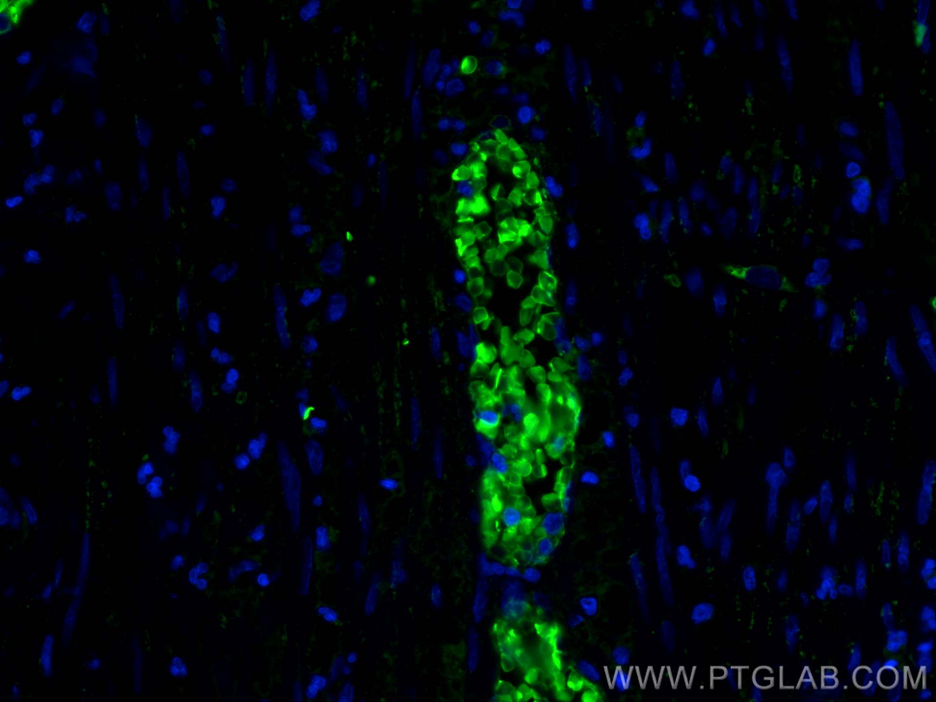 Immunofluorescence (IF) / fluorescent staining of human appendicitis tissue using HBB Polyclonal antibody (16216-1-AP)