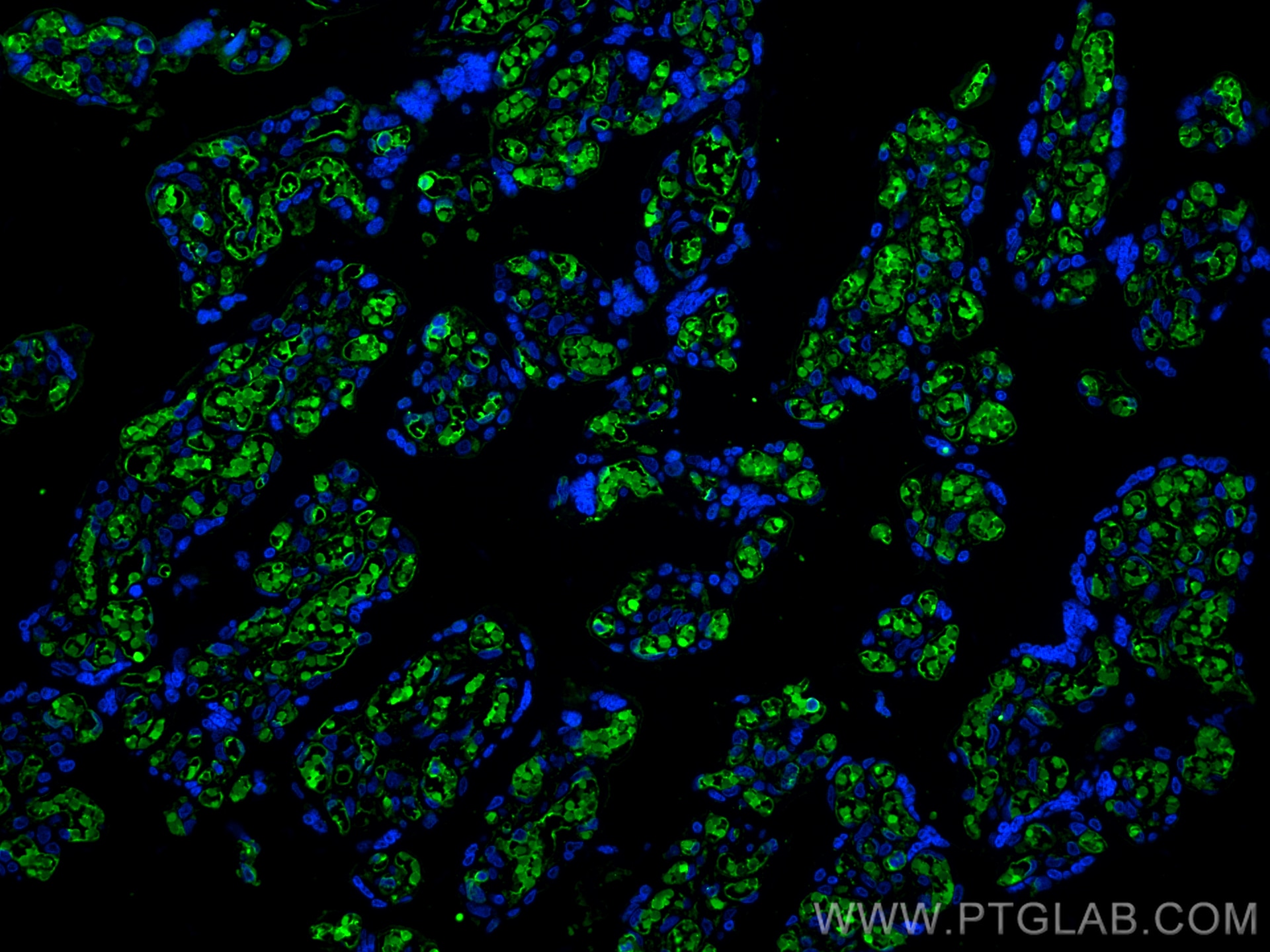 Immunofluorescence (IF) / fluorescent staining of human placenta tissue using HBB Polyclonal antibody (16216-1-AP)