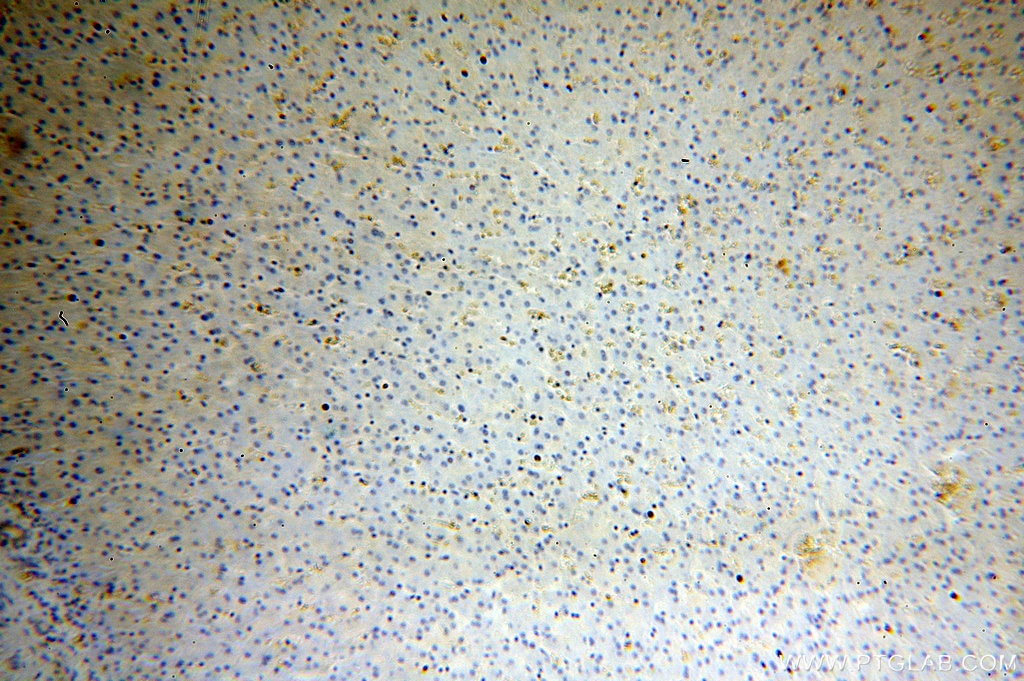 Immunohistochemistry (IHC) staining of human liver tissue using HBB Polyclonal antibody (16216-1-AP)