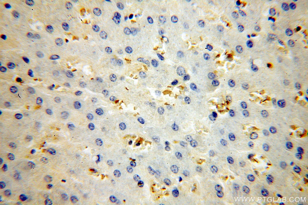 Immunohistochemistry (IHC) staining of human liver tissue using HBB Polyclonal antibody (16216-1-AP)