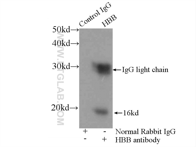 Immunoprecipitation (IP) experiment of mouse heart tissue using HBB Polyclonal antibody (16216-1-AP)