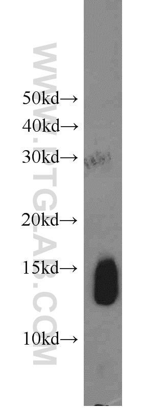 Western Blot (WB) analysis of human heart tissue using HBB Polyclonal antibody (16216-1-AP)