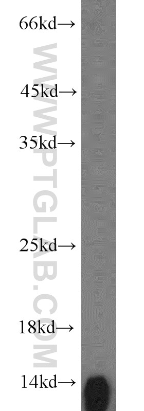 Western Blot (WB) analysis of human placenta tissue using HBB Polyclonal antibody (16216-1-AP)