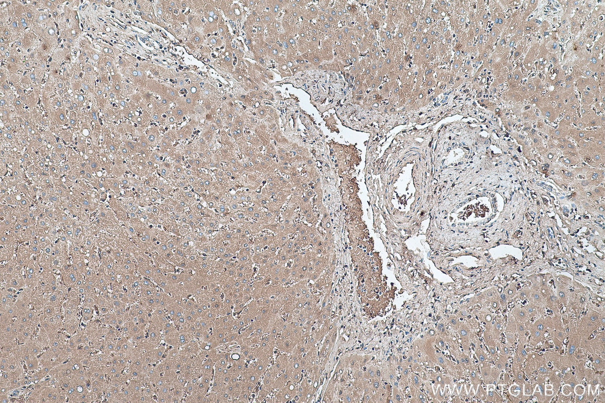 Immunohistochemistry (IHC) staining of human liver tissue using HBB Monoclonal antibody (67899-1-Ig)
