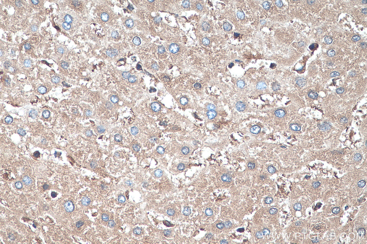 Immunohistochemistry (IHC) staining of human liver tissue using HBB Monoclonal antibody (67899-1-Ig)