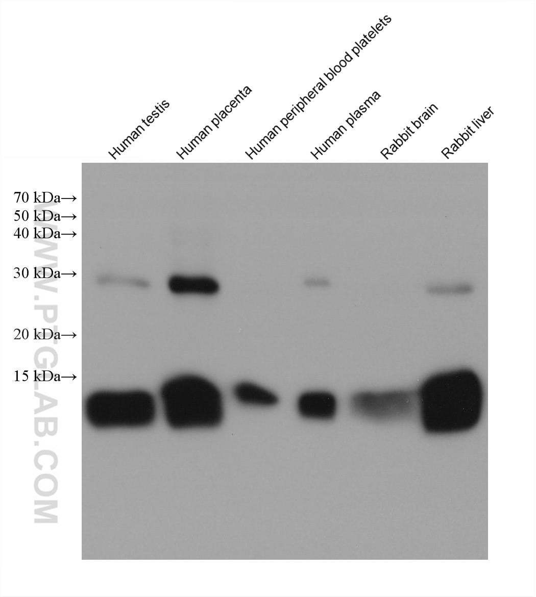 Western Blot (WB) analysis of various lysates using HBB Monoclonal antibody (67899-1-Ig)