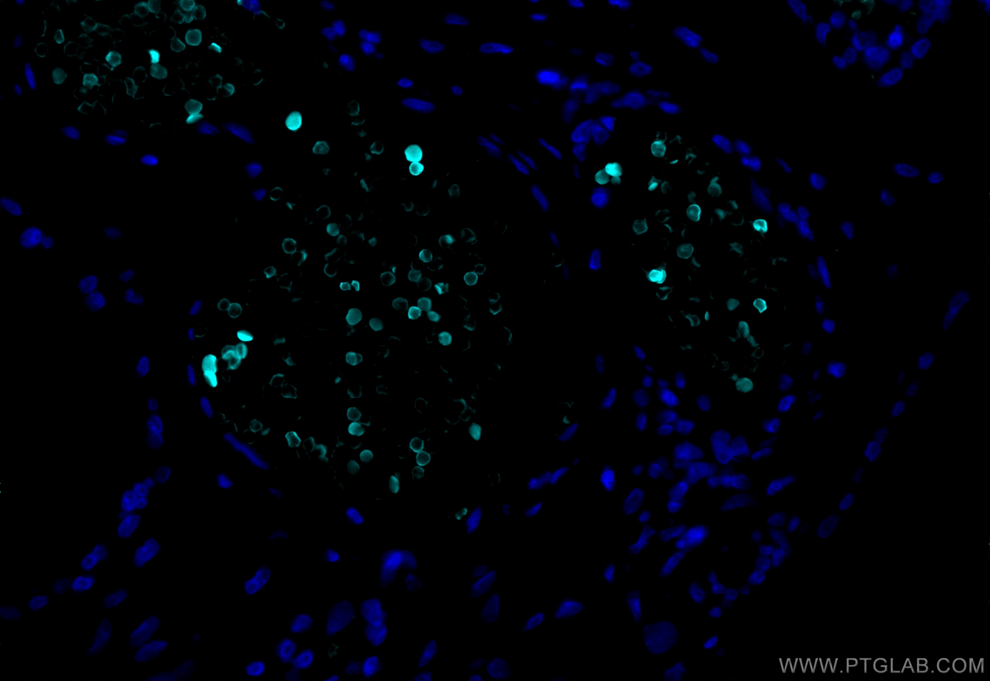 Immunofluorescence (IF) / fluorescent staining of human placenta tissue using CoraLite® Plus 750-conjugated HBB Polyclonal antib (CL750-16216)