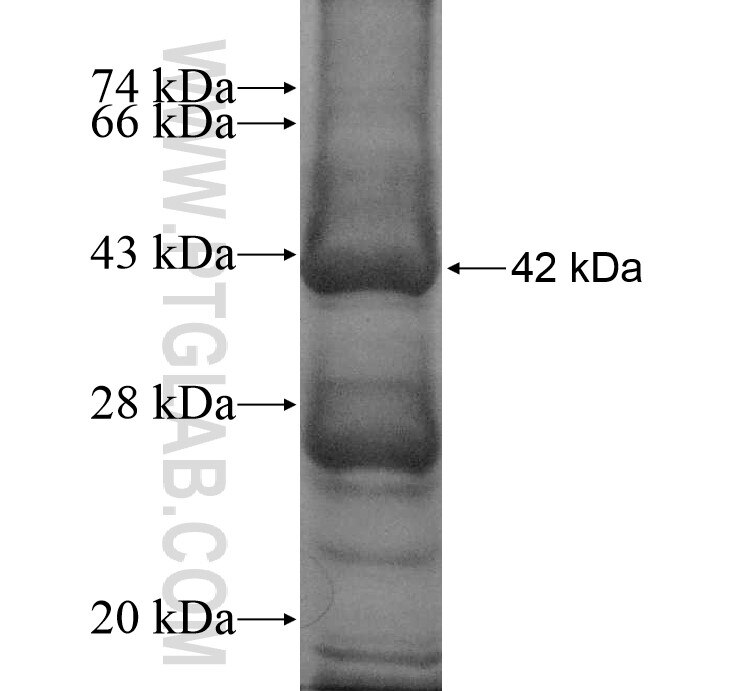 HBB fusion protein Ag9216 SDS-PAGE