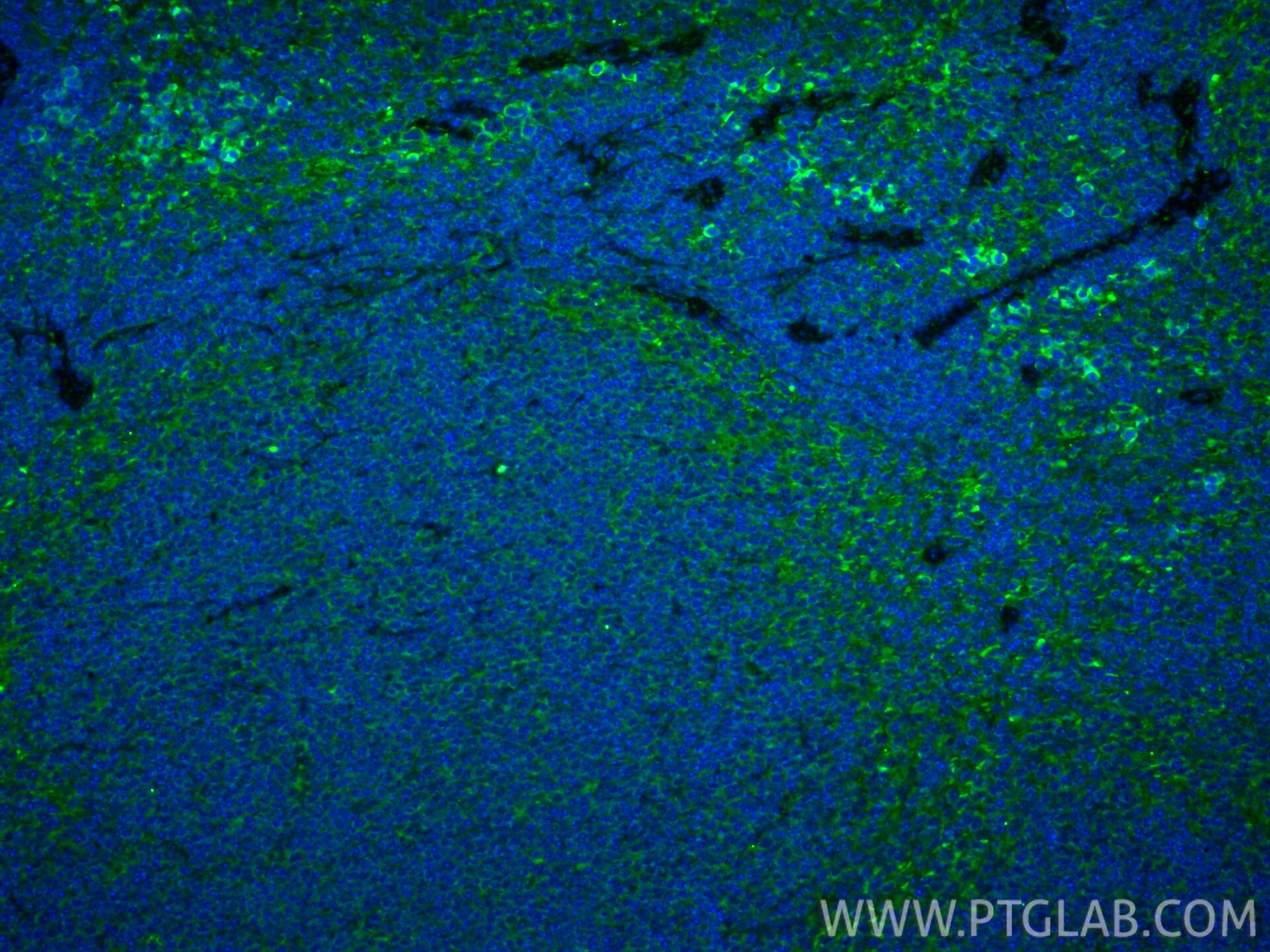 IF Staining of mouse spleen using 16824-1-AP Immunofluorescence (IF) / fluorescent staining of mouse spleen tissue using HBD Polyclonal antibody (16824-1-AP)