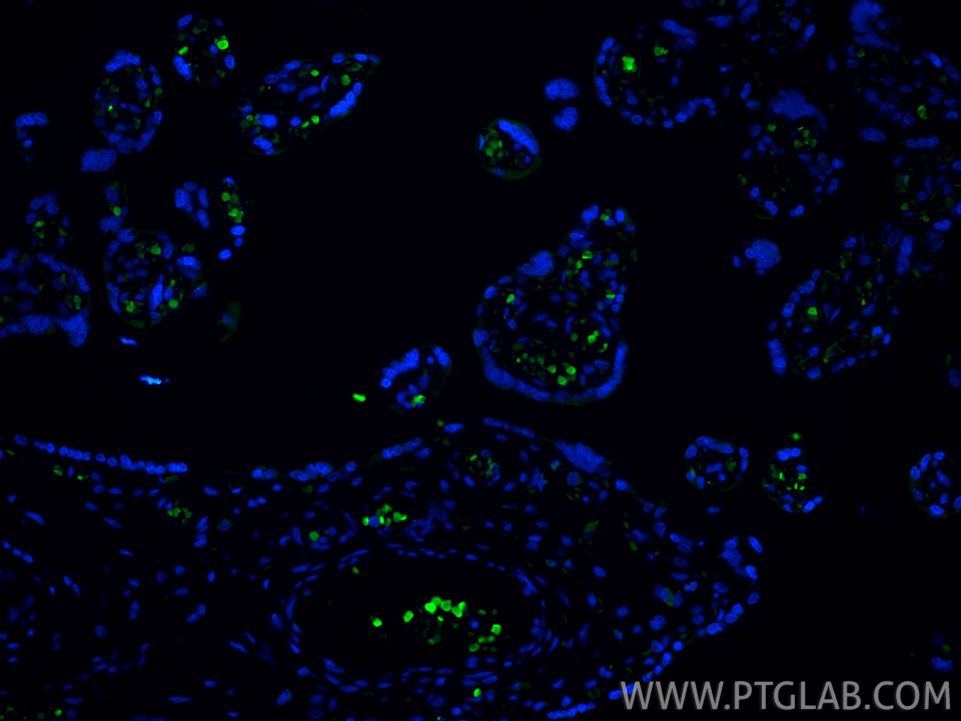 IF Staining of human placenta using 16824-1-AP Immunofluorescence (IF) / fluorescent staining of human placenta tissue using HBD Polyclonal antibody (16824-1-AP)